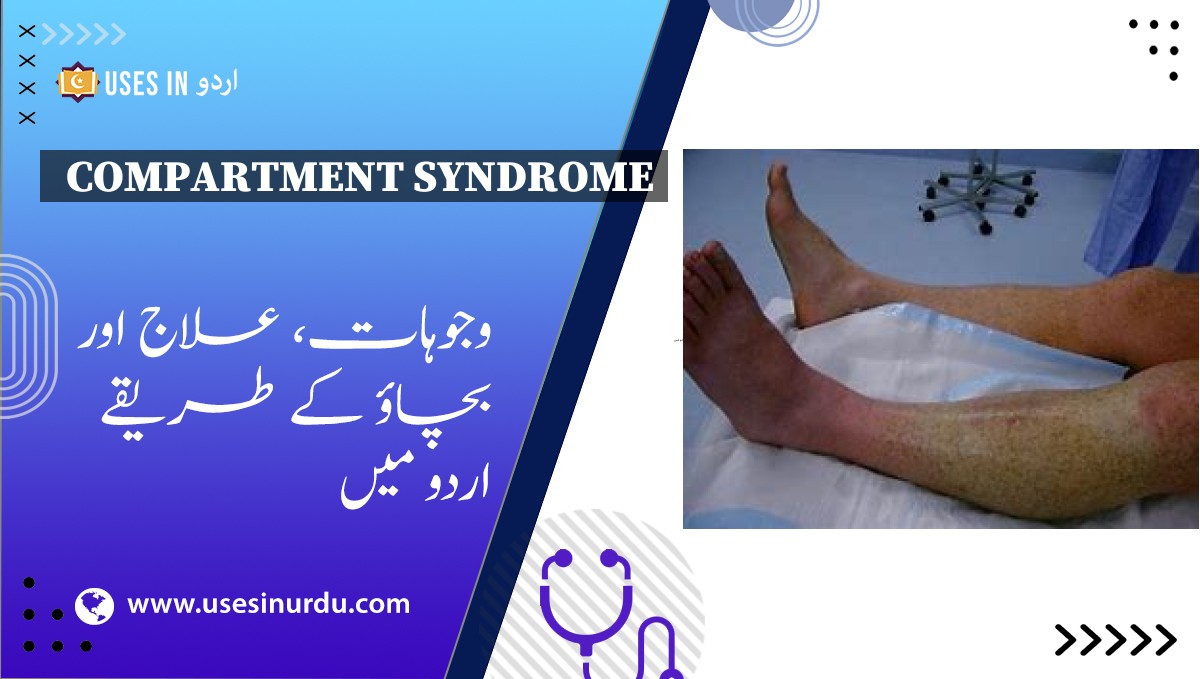 Compartment Syndrome