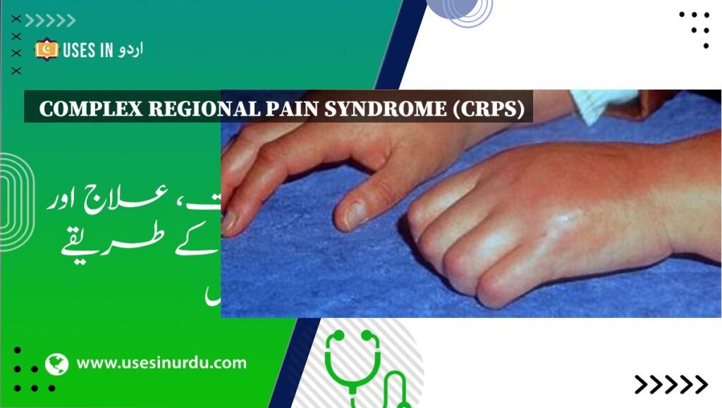 Complex Regional Pain Syndrome (CRPS)