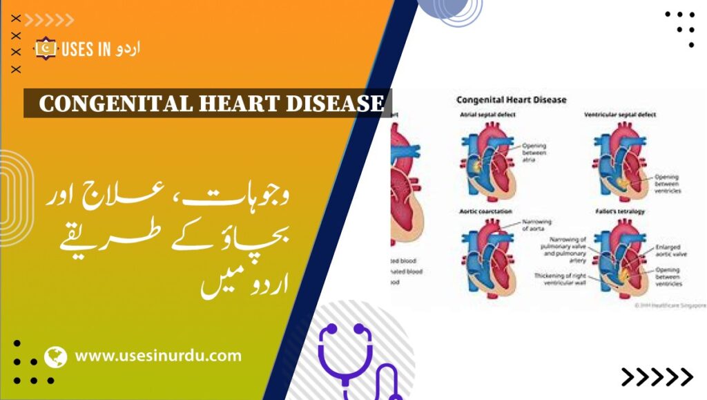 Congenital Heart Disease