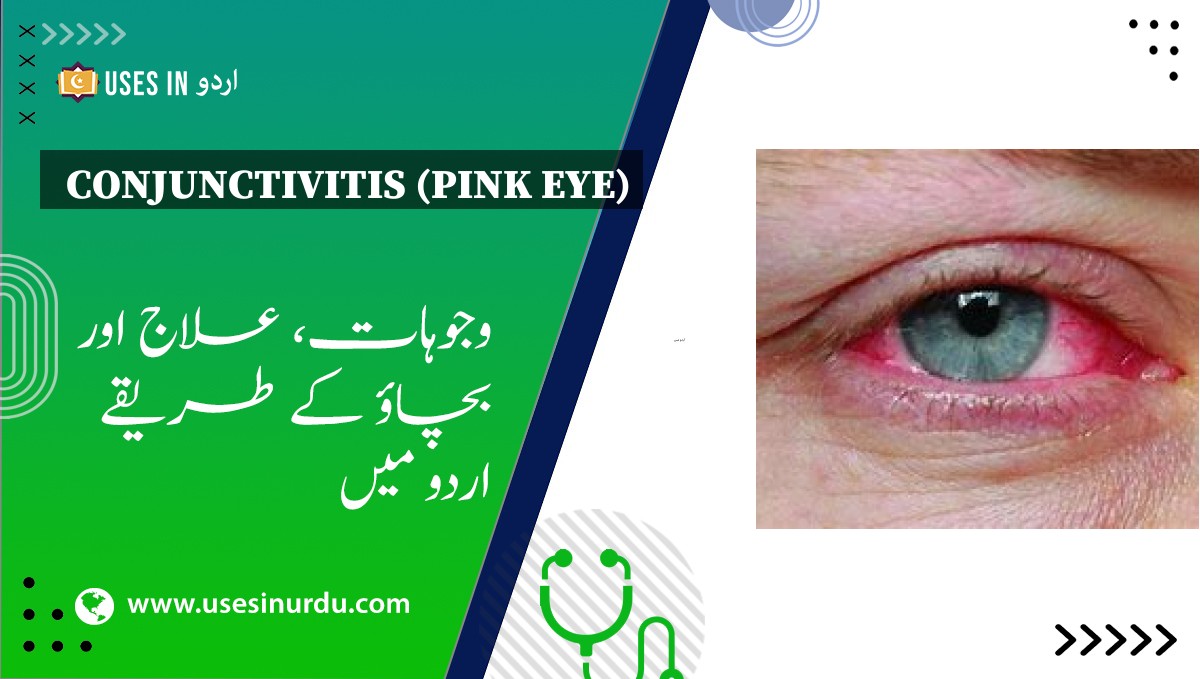 Conjunctivitis (Pink Eye)