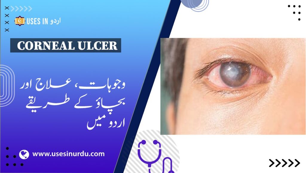 Corneal Ulcer