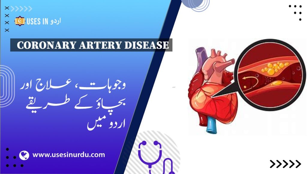 Coronary Artery Disease