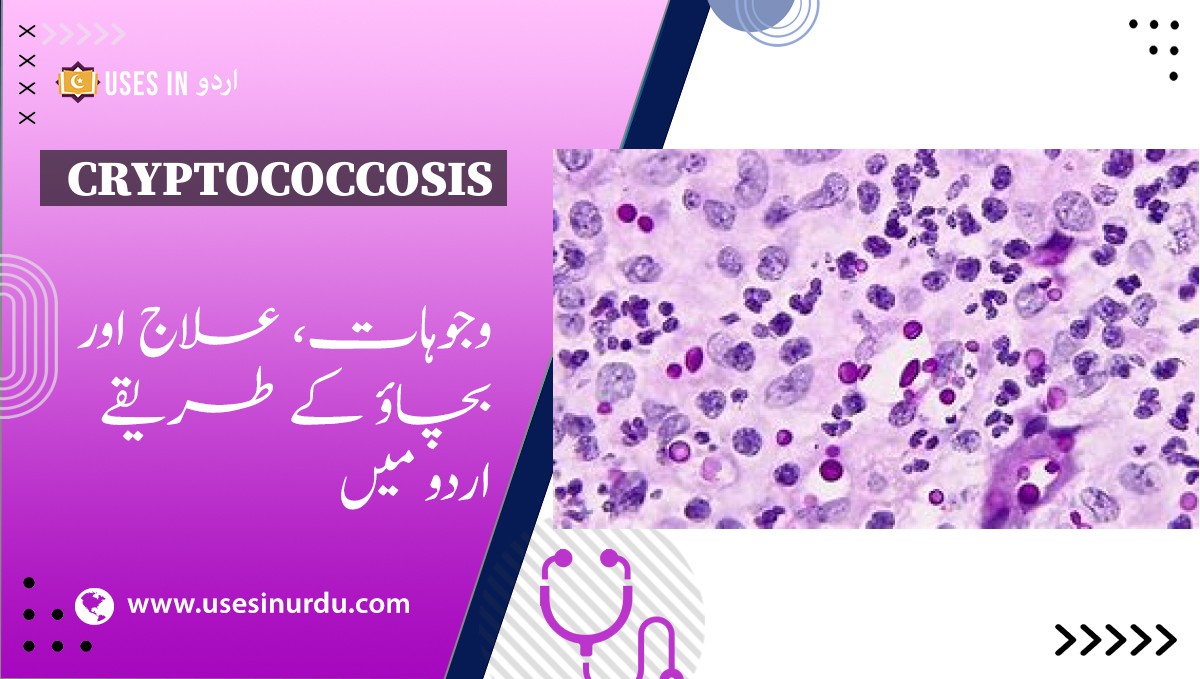 Cryptococcosis