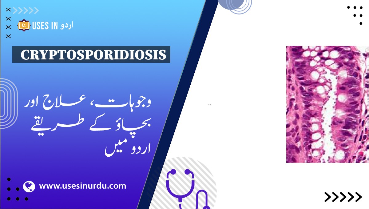 Cryptosporidiosis