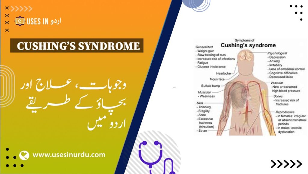 Cushing’s Syndrome