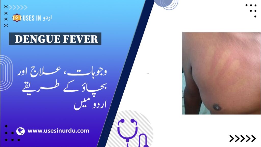 Dengue Fever