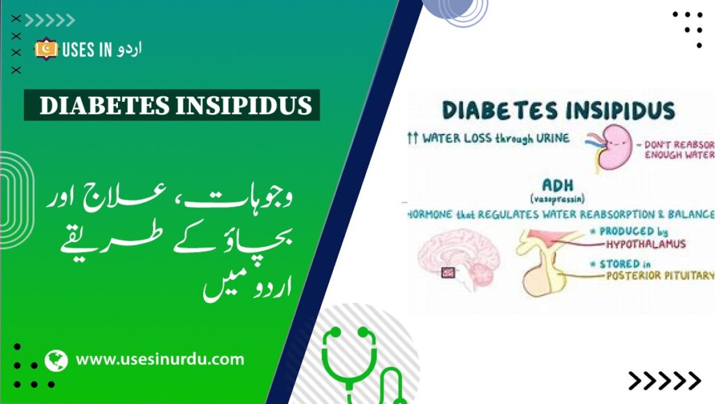 Diabetes Insipidus