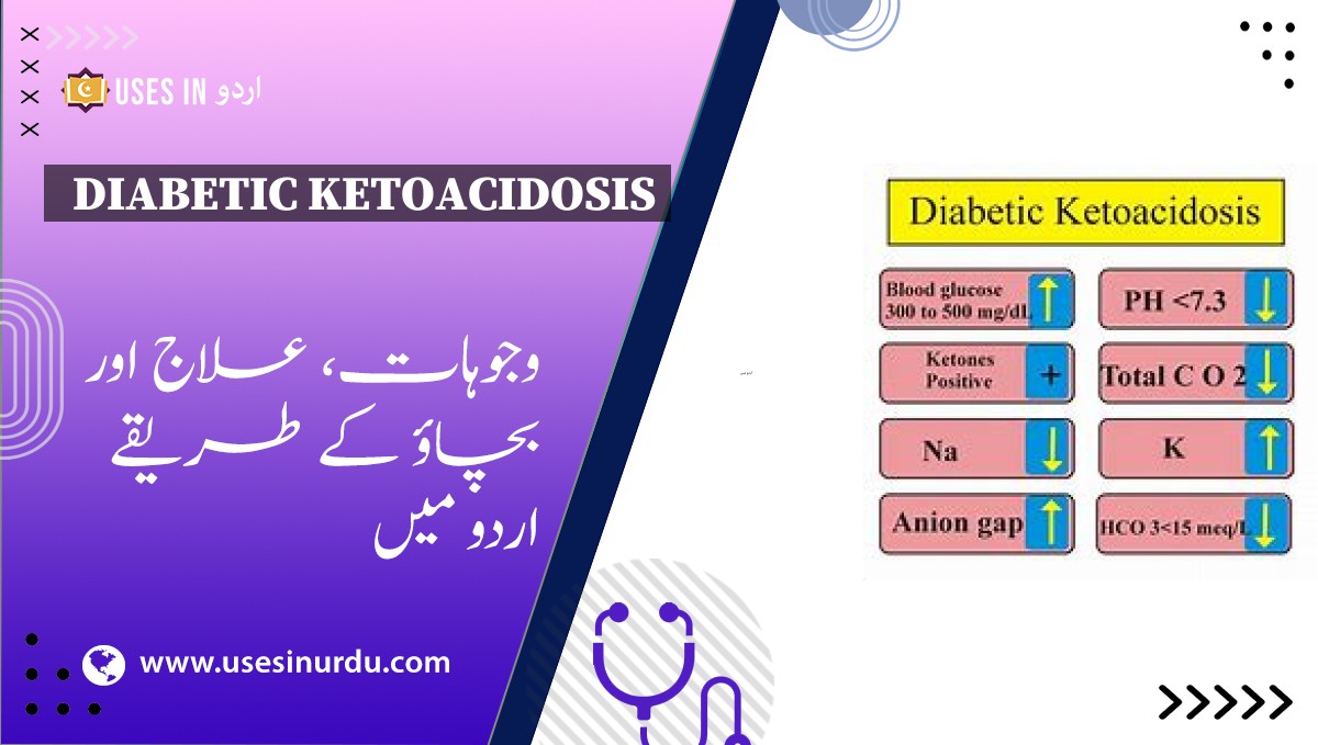 Diabetic Ketoacidosis