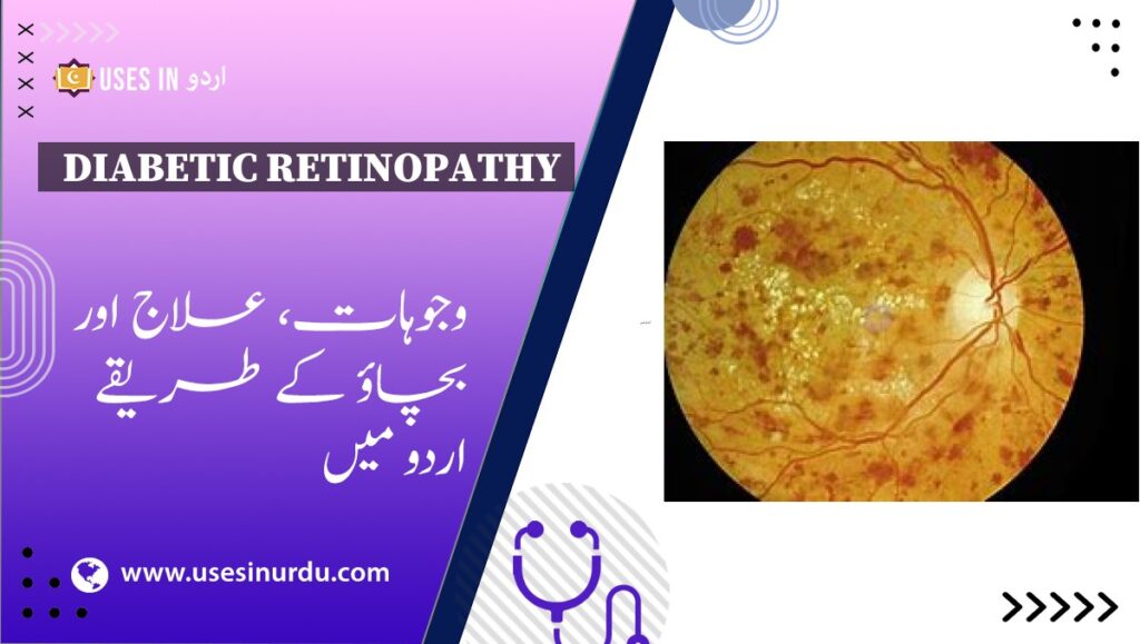 Diabetic Retinopathy