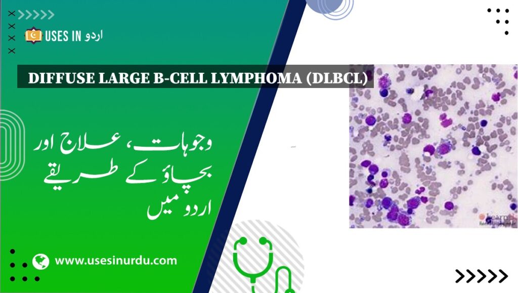 Diffuse Large B-Cell Lymphoma (DLBCL)