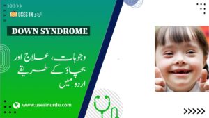 Down Syndrome