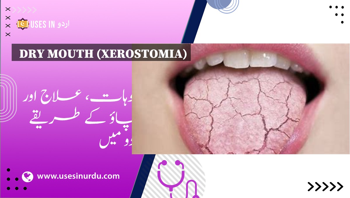 Dry Mouth (Xerostomia)