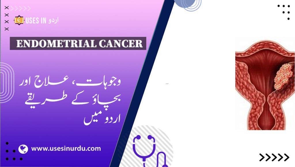 Endometrial Cancer