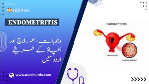 Endometritis