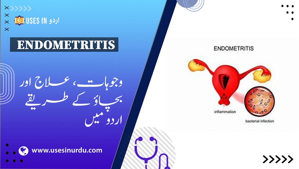 Endometritis