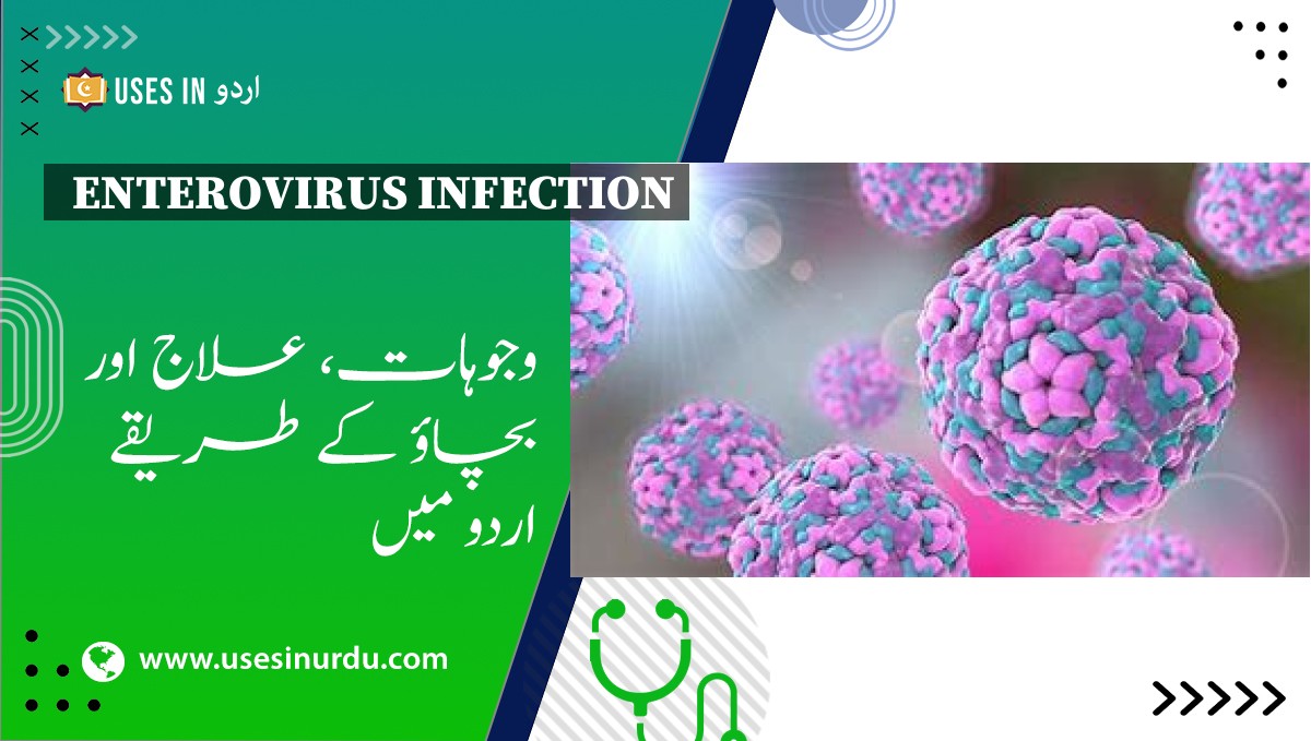 Enterovirus Infection