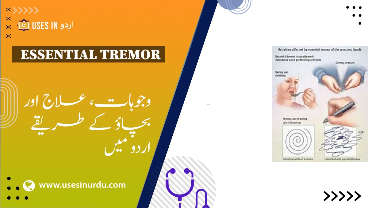 Essential Tremor