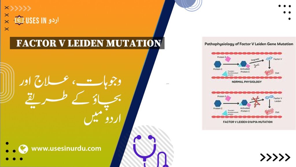 Factor V Leiden Mutation