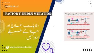 Factor V Leiden Mutation
