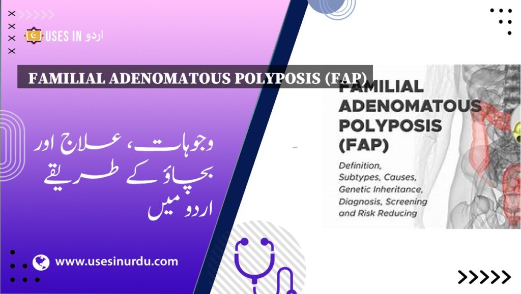 Familial Adenomatous Polyposis (FAP)