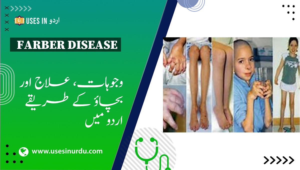 Farber Disease