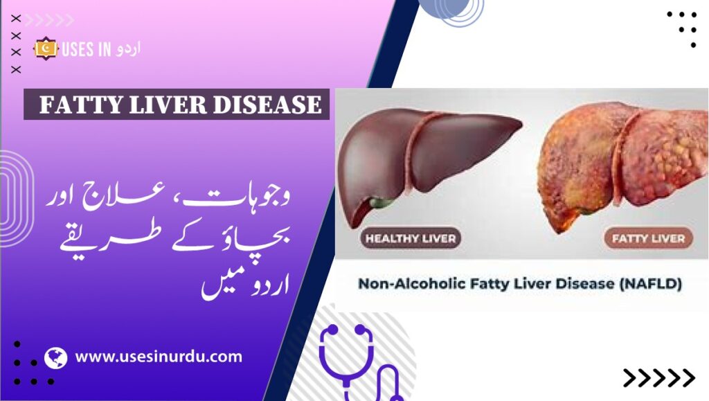 Fatty Liver Disease