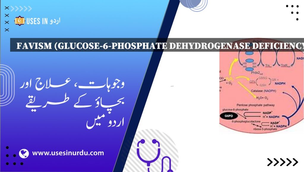 Favism (Glucose-6-Phosphate Dehydrogenase Deficiency)