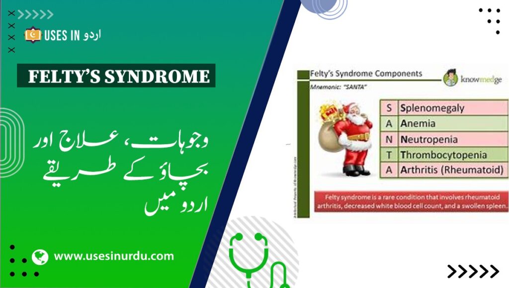 Felty’s Syndrome