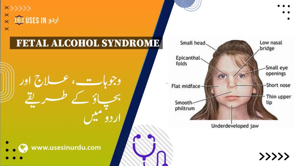 Fetal Alcohol Syndrome