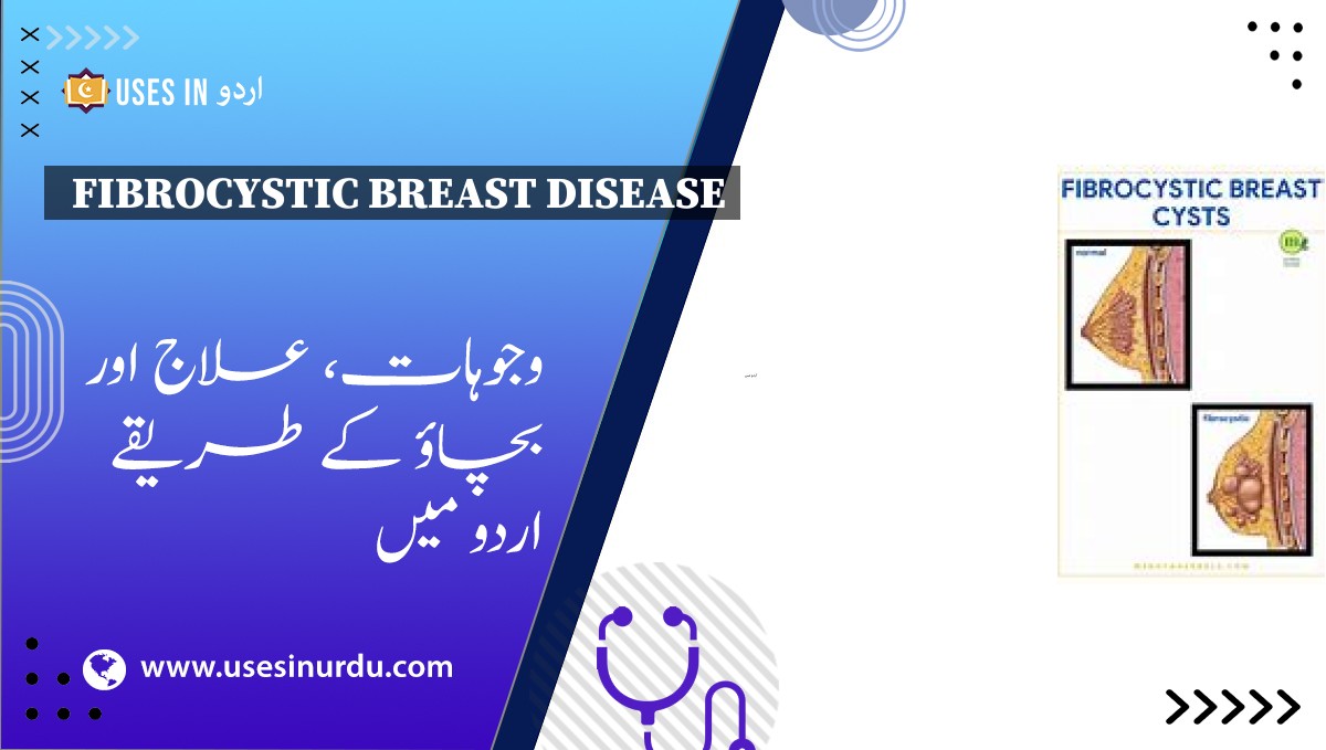 Fibrocystic Breast Disease