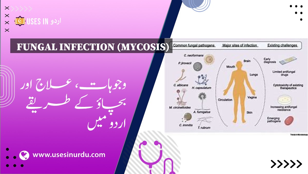 Fungal Infection (Mycosis)