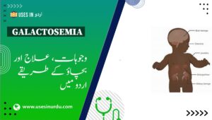Galactosemia