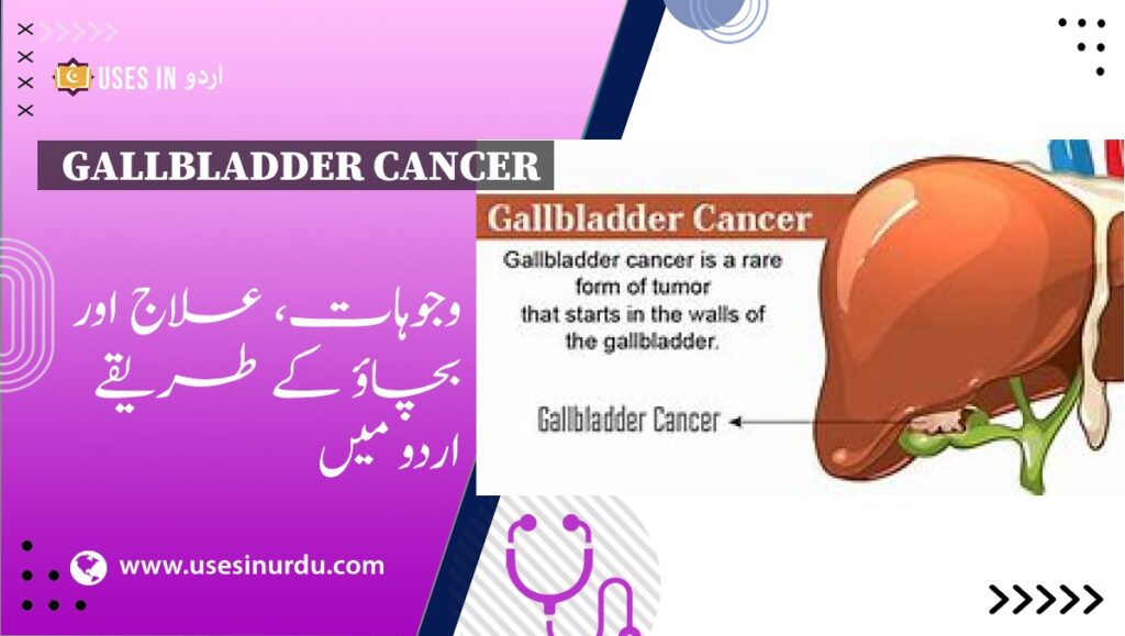 Gallbladder Cancer