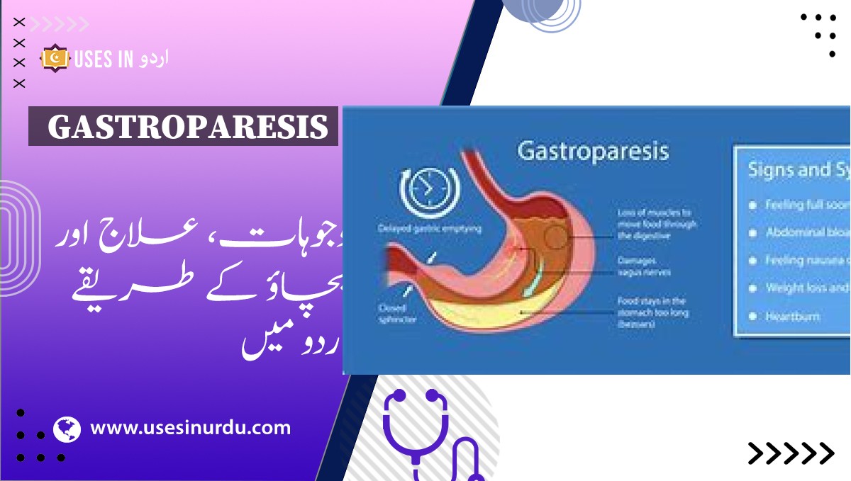 Gastroparesis