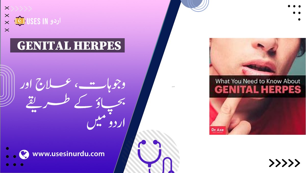 Genital Herpes