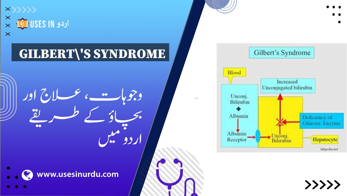 Gilbert's Syndrome