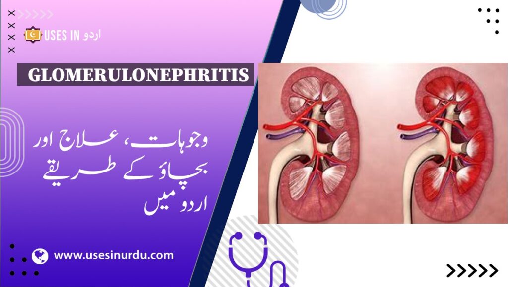 Glomerulonephritis