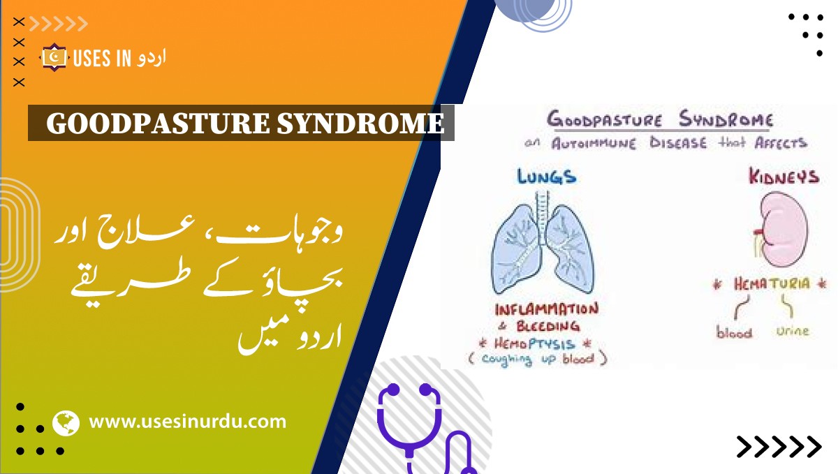 Goodpasture Syndrome