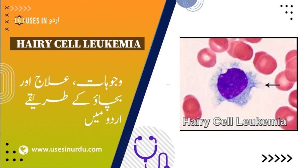 Hairy Cell Leukemia