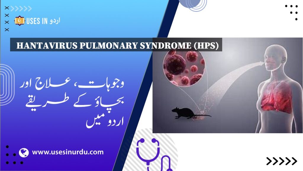 Hantavirus Pulmonary Syndrome (HPS)