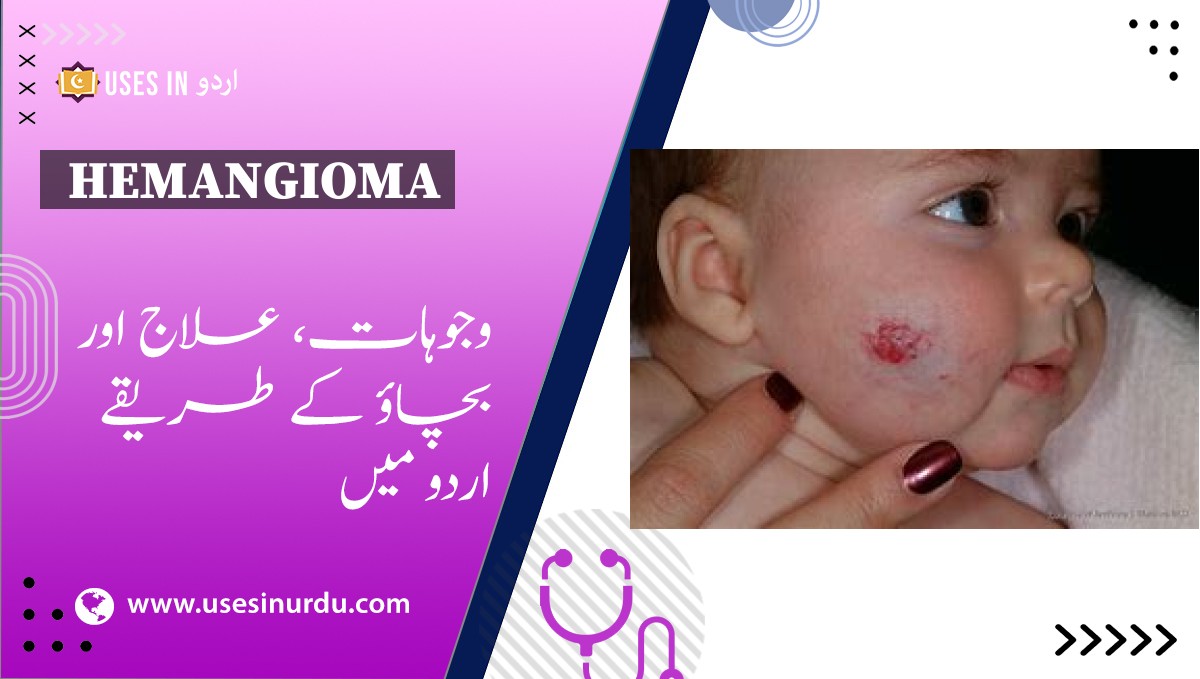 Hemangioma