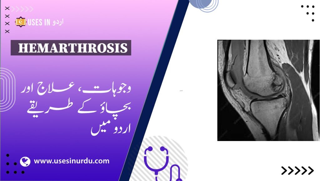 Hemarthrosis