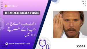 Hemochromatosis