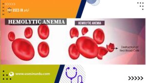 Hemolytic Anemia
