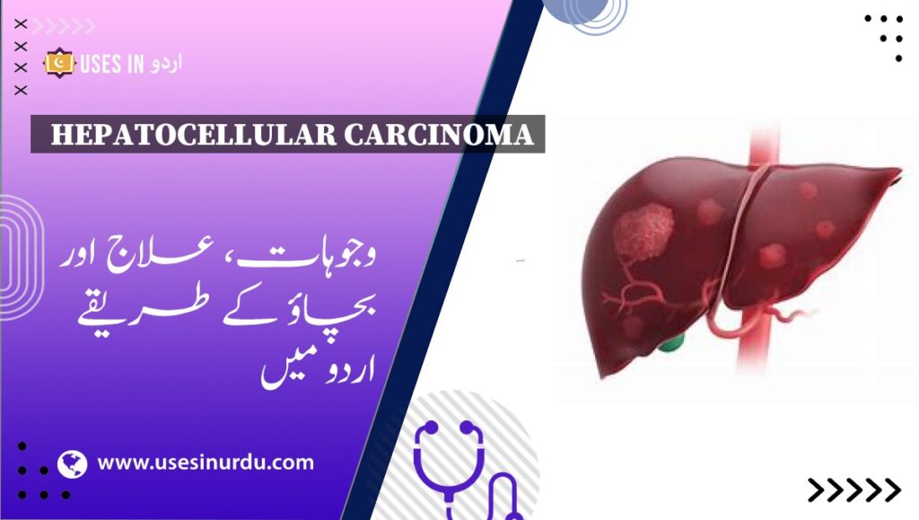 Hepatocellular Carcinoma