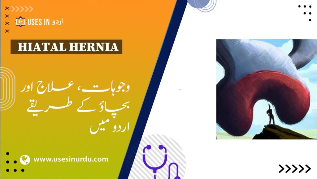 Hiatal Hernia