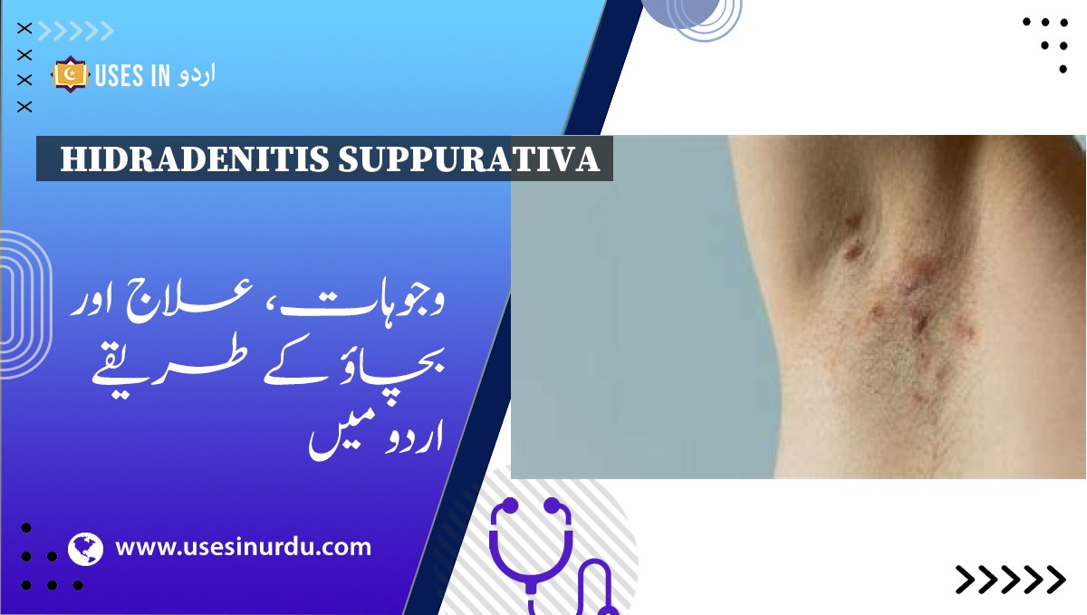 Hidradenitis Suppurativa