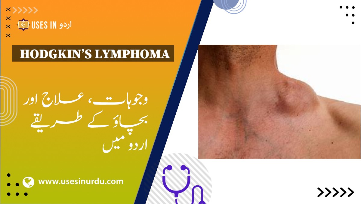 Hodgkin’s Lymphoma