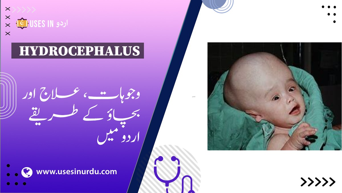 Hydrocephalus