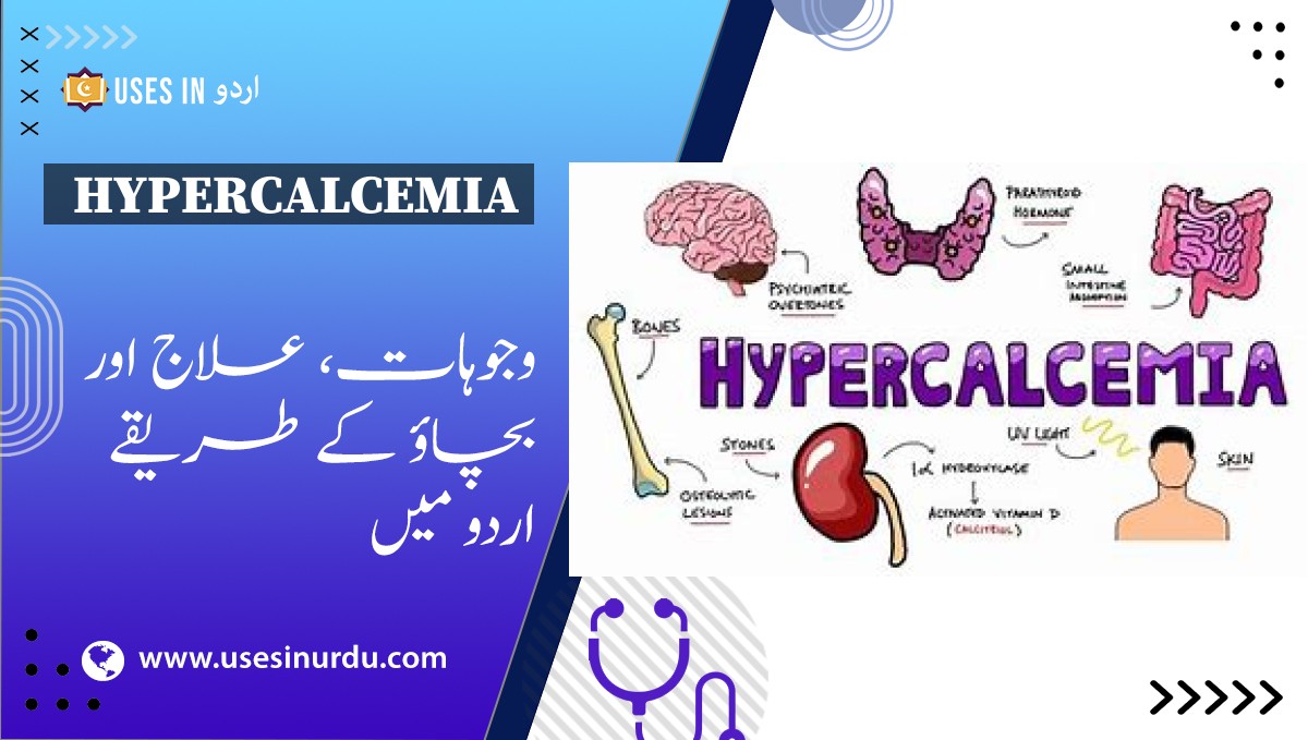 Hypercalcemia